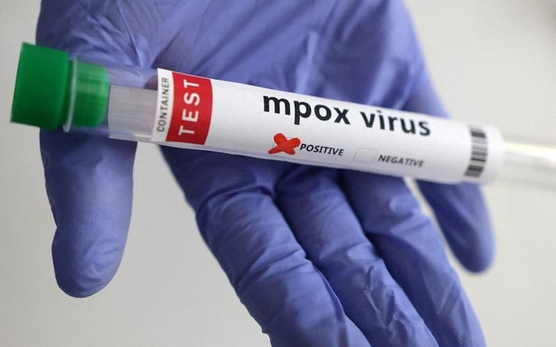 Mpox: Το νέο στέλεχος αλλάζει γρήγορα – Τι ανησυχεί τους επιστήμονες